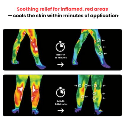 Vivenity™ ThermaRelief Knee Pro